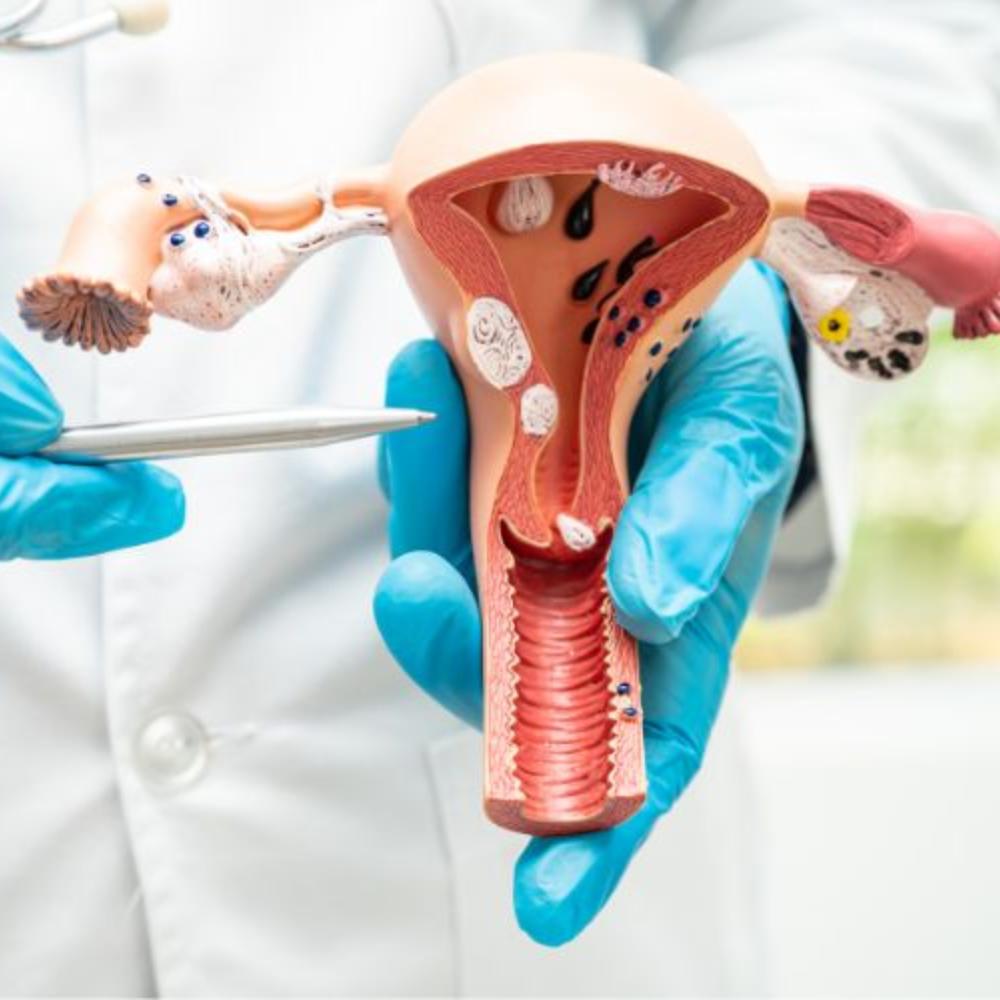 Lichen Sclerosus