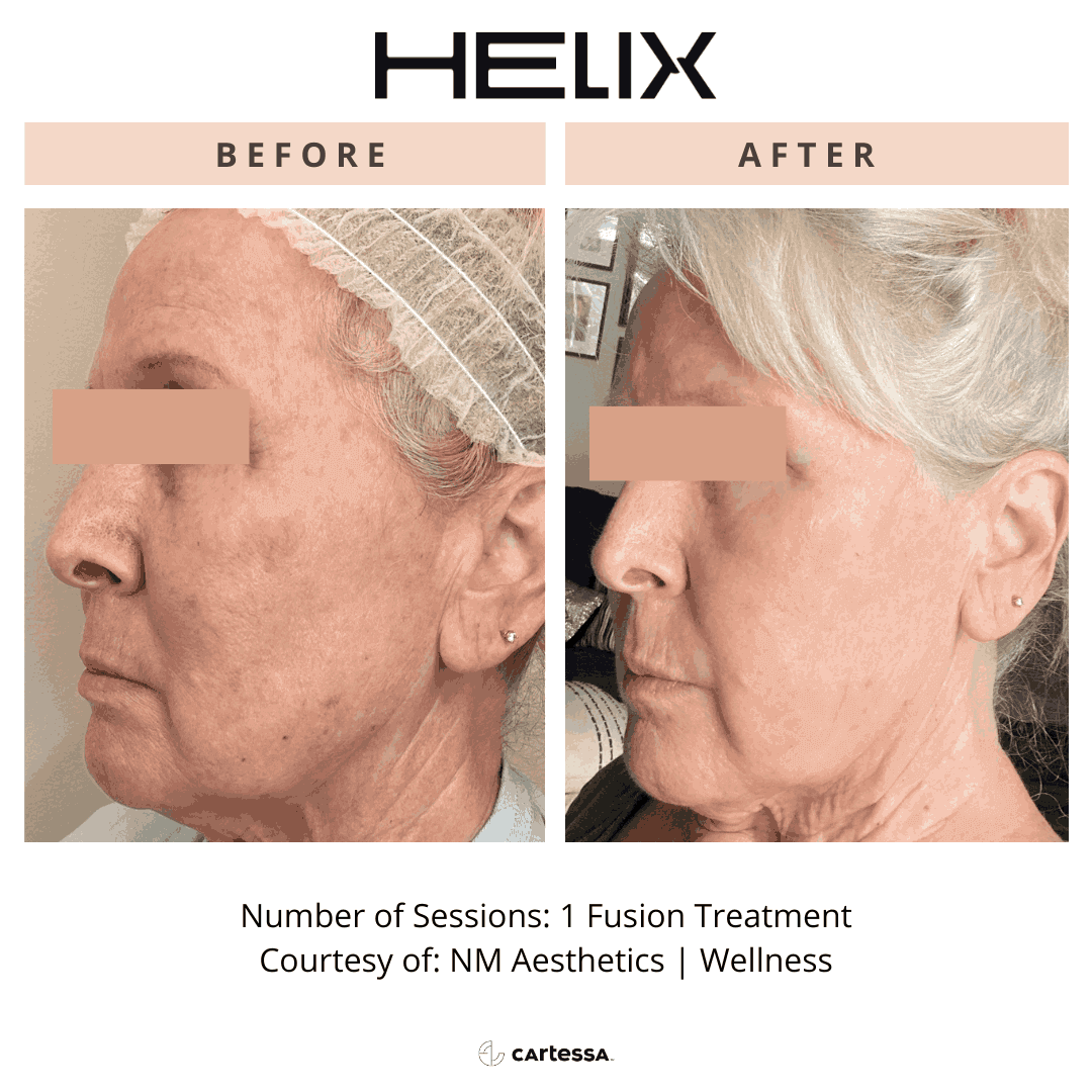 Helix8169340698082-enchanted